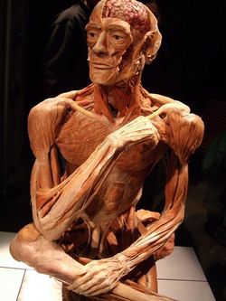 A body from Body Worlds